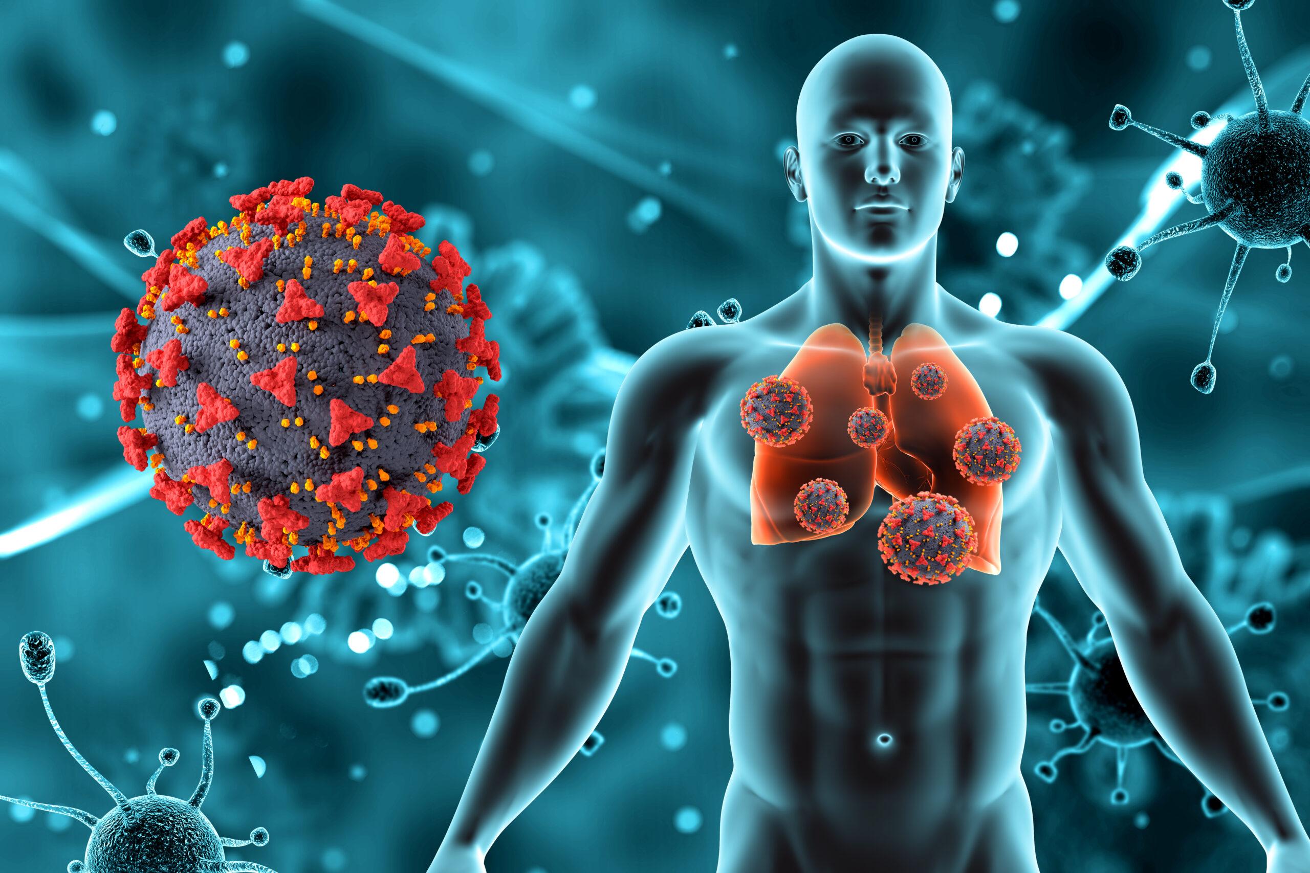 Doença pulmonar micobacteriana não tuberculosa (NTM-PD)