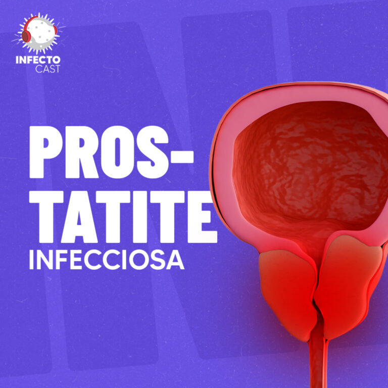 Podcast 6 #147 – Prostatite infecciosa