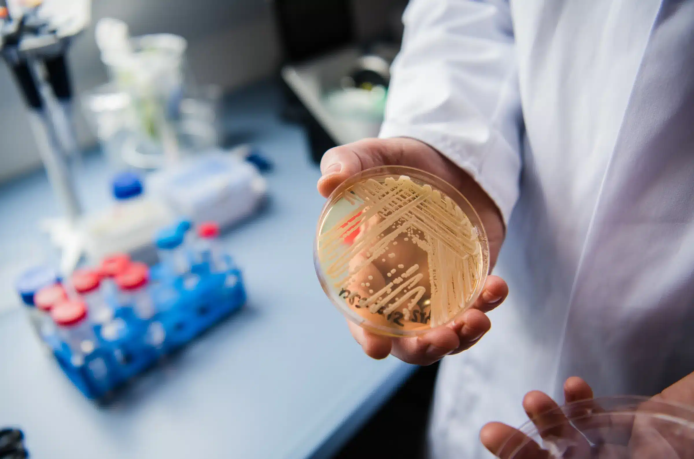 Placa de Petri com cultura de Candida auris em laboratório hospitalar, usada em vigilância, isolamento e protocolos de desinfecção para prevenir IRAS.